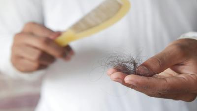 Beleza Capilar: Como Prevenir a Queda de Cabelo